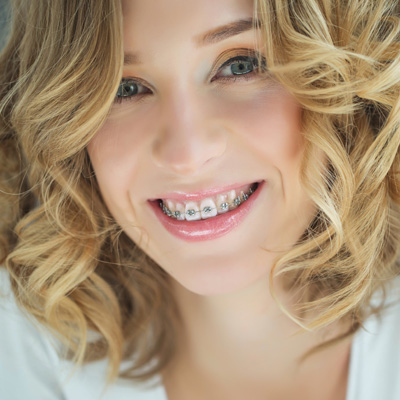 A woman with straight teeth and braces smiles at the camera, showcasing her smile against a white background.