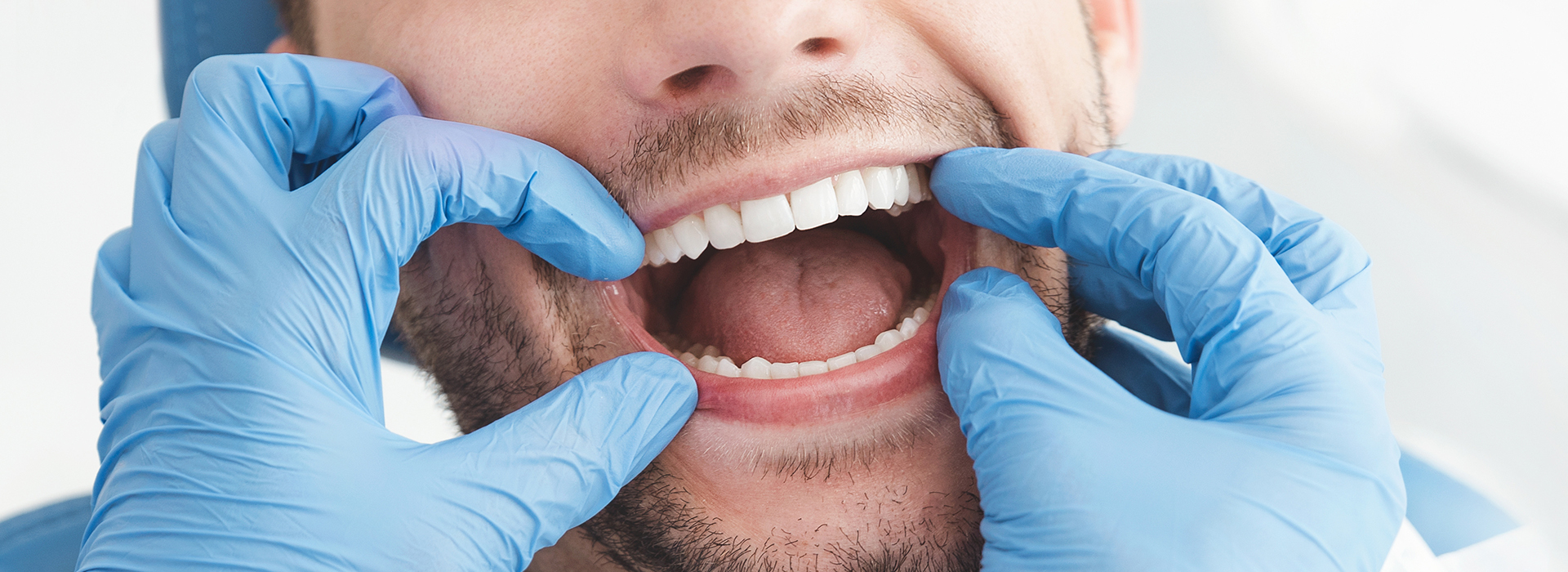 A man wearing blue gloves holds his mouth open with both hands while looking upwards, possibly at a dentist.